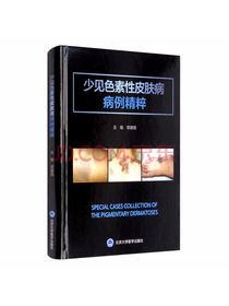 少见色素性皮肤病病例精粹