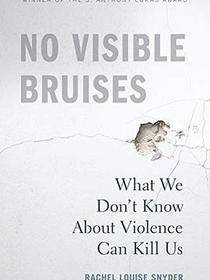 No Visible Bruises