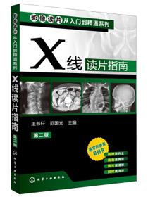 影像读片从入门到精通系列：X线读片指南（第2版）