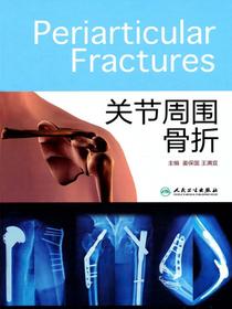 关节周围骨折