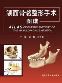 颌面骨骼整形手术图谱