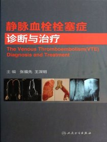 静脉血栓栓塞症诊断与治疗
