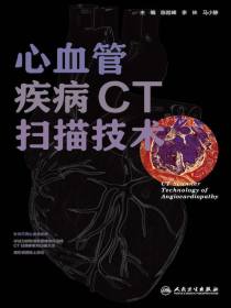 心血管疾病CT扫描技术