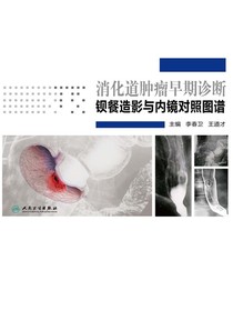 消化道肿瘤早期诊断：钡餐造影与内镜对照图谱