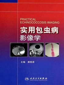 实用包虫病影像学