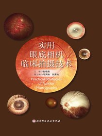 实用眼底相机临床拍摄技术