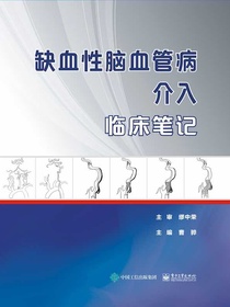 缺血性脑血管病介入临床笔记
